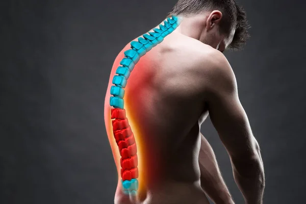 Dolore alla colonna vertebrale, un uomo con mal di schiena, lesioni alla schiena umana, concetto di trattamenti chiropratici — Foto Stock