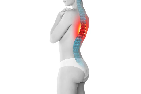 Omurgada ağrı, sırt ağrısı olan bir kadın, insan sırtında yaralanma, beyaz arka planda izole chiropractic tedaviler kavramı — Stok fotoğraf