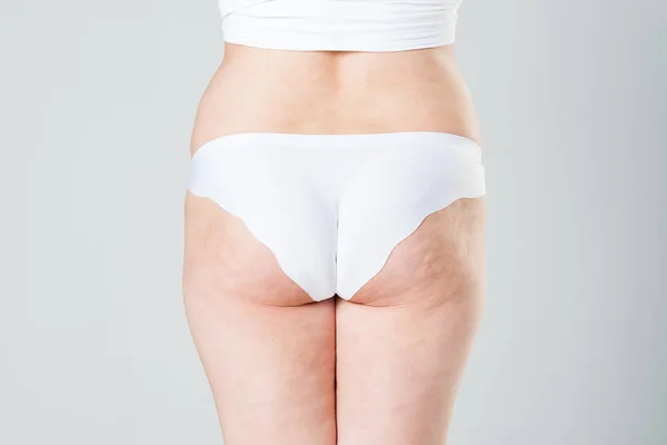 Vrouw met dikke cellulite benen en billen, overgewicht vóór na concept, obesitas vrouwelijk lichaam, achteraanzicht — Stockfoto