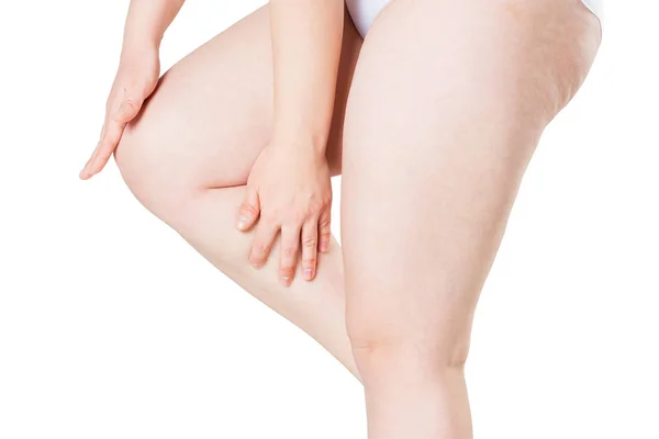 Dolor de rodilla, inflamación articular, aislado sobre fondo blanco — Foto de Stock
