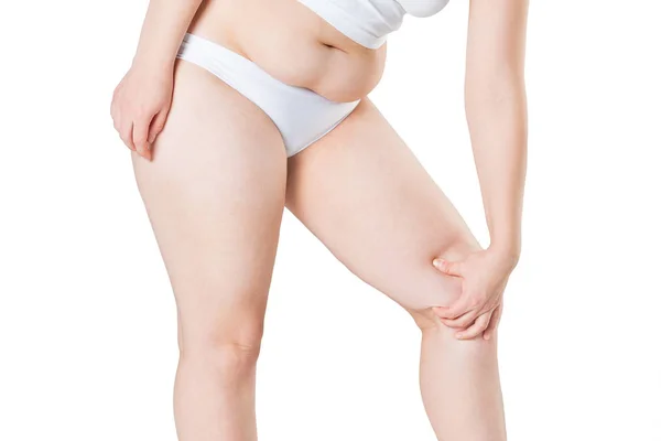 Rasva naisten jalat eristetty valkoisella pohjalla — kuvapankkivalokuva
