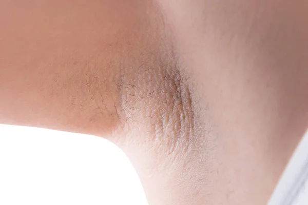 Pele da axila após a remoção do cabelo a laser — Fotografia de Stock