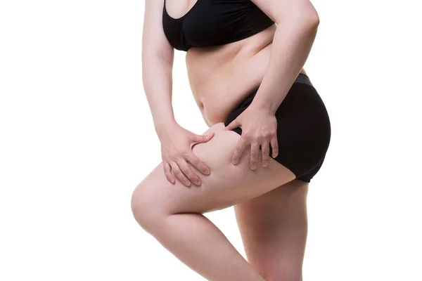 Mulher com excesso de peso com coxas gordas, obesidade pernas femininas isoladas no fundo branco — Fotografia de Stock