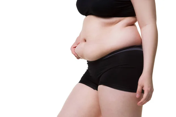 Abdominoplastia, piel flácida en un vientre gordo, concepto de cirugía plástica —  Fotos de Stock