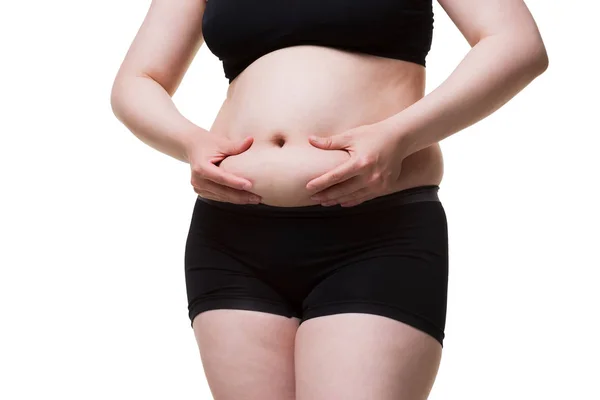 Tummy tuck, flabby skin on a fat belly, plastic surgery concept — Stock Photo, Image