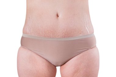 Beyaz arka plan üzerinde izole çatlakları ile kadın göbek