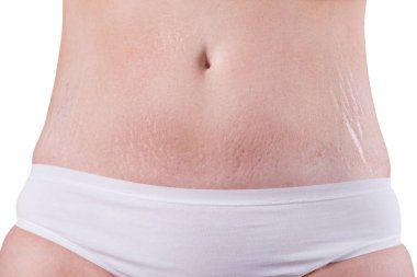 Beyaz arka plan üzerinde izole çatlakları ile kadın göbek