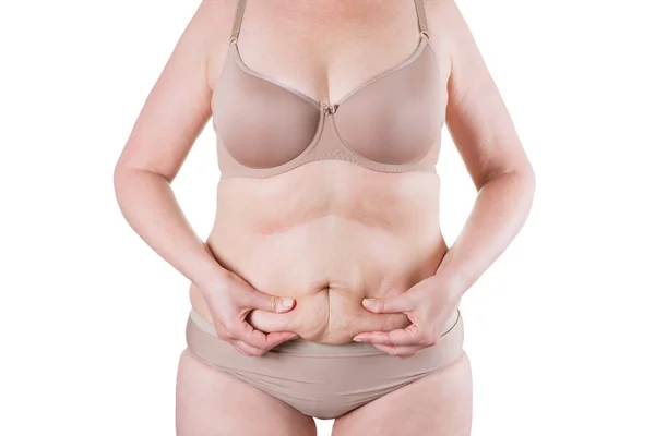 Tummy tuck, pelle flaccida su una pancia grassa, concetto di chirurgia plastica — Foto Stock