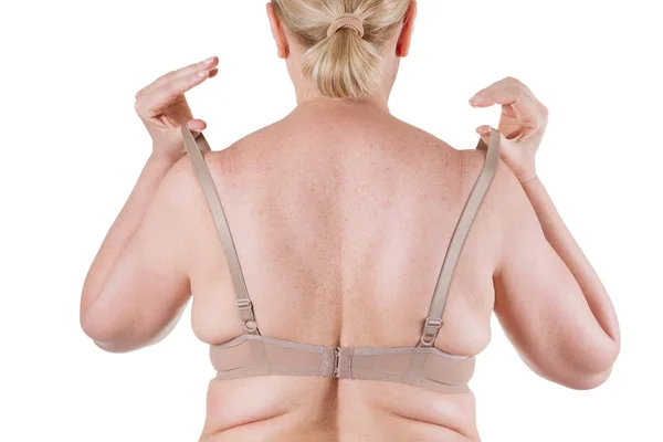 Fettleibigkeit weiblichen Körper, dicke Frau zurück isoliert auf weißem Hintergrund — Stockfoto