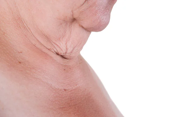 Flabby skin on the neck of an elderly woman isolated on white background — Stock Photo, Image