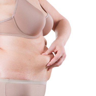 Tummy Tuck, yağlı göbek üzerinde gevşek cilt, plastik cerrahi kavramı