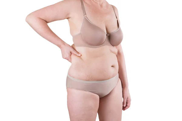 Tummy tuck, pelle flaccida su una pancia grassa, concetto di chirurgia plastica — Foto Stock