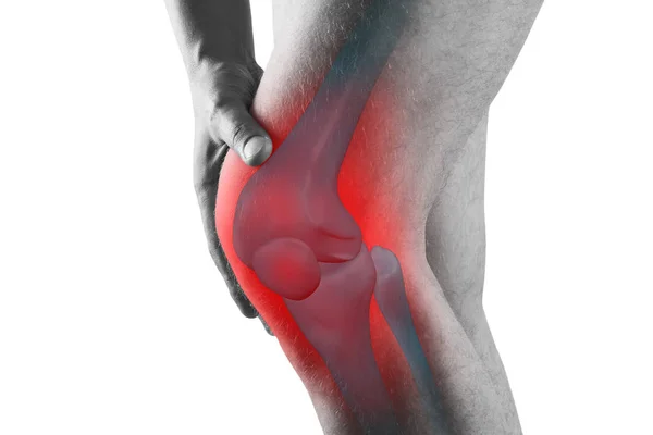 膝盖疼痛，男子腿痛，脊柱治疗概念，隔离在白色背景 — 图库照片