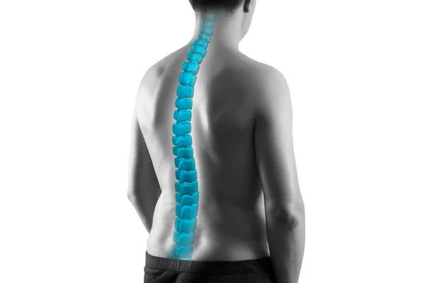 La colonna vertebrale umana, sciatica e scoliosi isolate su sfondo bianco, concetto di trattamento chiropratico — Foto Stock