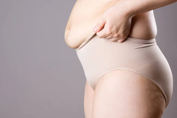 Mujer gorda en bragas correctivas, vientre flácido después del embarazo, cuerpo femenino con sobrepeso sobre fondo gris — Foto de Stock