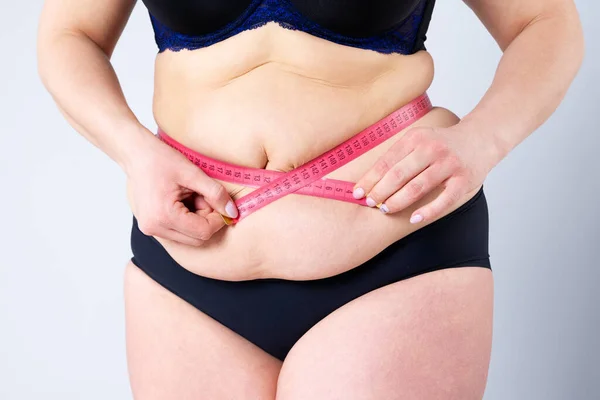 Dicke Frau Mit Schlaffem Bauch Misst Taillengröße Übergewichtiger Weiblicher Körper — Stockfoto
