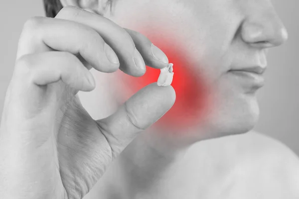 Extração Dentária Sabedoria Homem Que Sofre Dor Dente Área Dolorosa — Fotografia de Stock