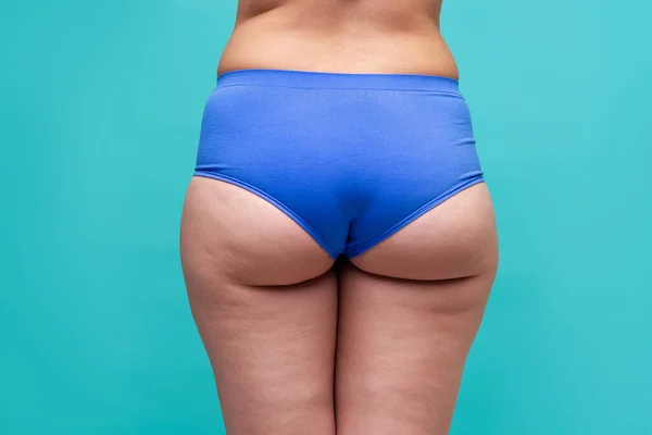 Quadris Gordos Nádegas Obesidade Corpo Feminino Fundo Azul Corpo Conceito — Fotografia de Stock