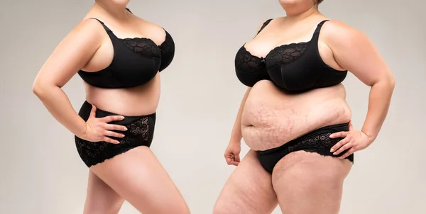 Woman's body before and after weight loss on gray background, plastic surgery concept