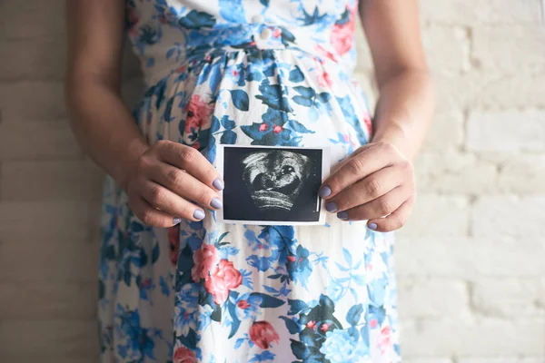Kobieta Ciąży Obrazie Usg Wyświetlone Kwieciste Sukienki Baby — Zdjęcie stockowe