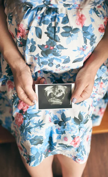 Gravid Kvinna Blommig Klänning Visar Ultraljud Bild Baby — Stockfoto