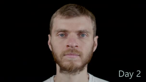 En man före och efter sju dagars terapeutisk torrfasta - utan mat och vatten, minus 9 kg — Stockvideo