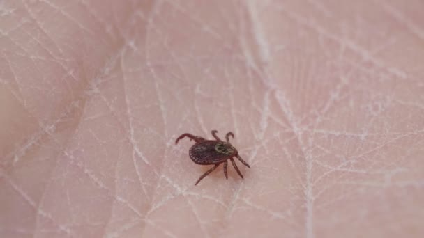 Blood-sucking mite tick creepes on the human skin through the hair — Stock Video