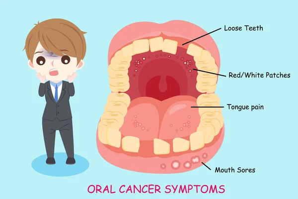 Hombre Con Síntomas Cáncer Oral Fondo Azul — Vector de stock