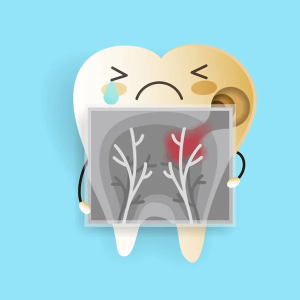 Tooth Met Verval Probleem Blauwe Achtergrond — Stockvector