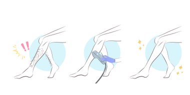 kadın bacak epilasyon beyaz zemin üzerine