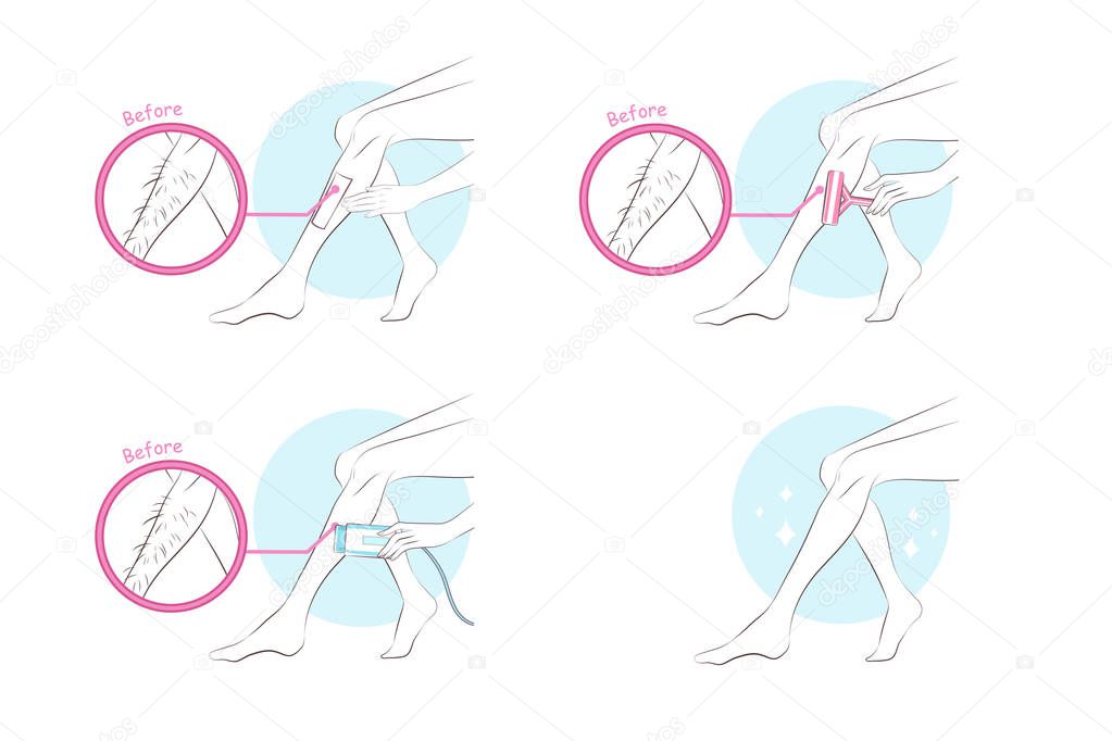 woman leg hair removal on the white background
