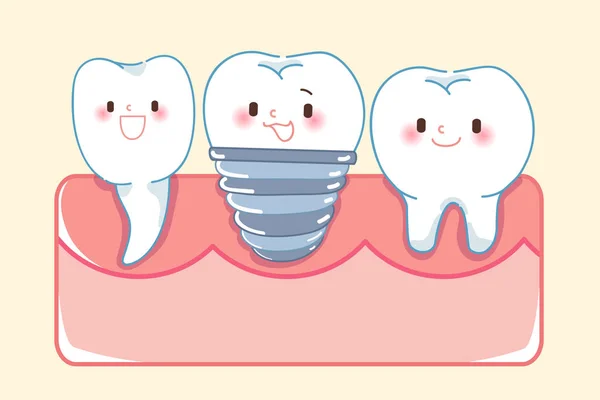 Concept Dent Implant Dessin Animé Mignon Sur Fond Jaune — Image vectorielle