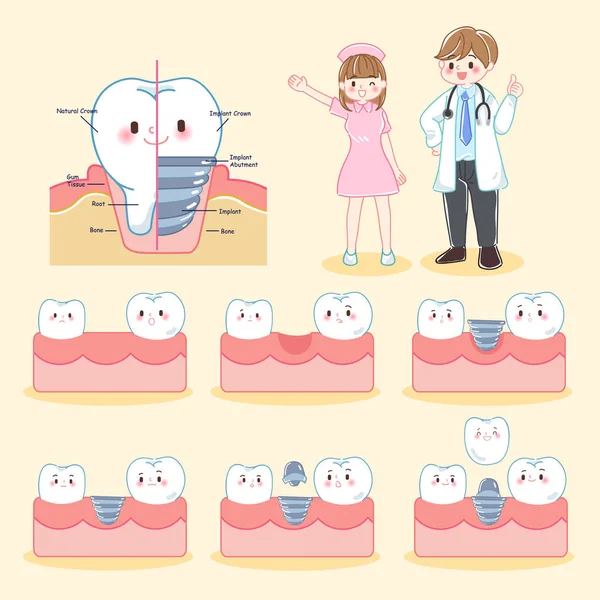 Dentiste Dessin Animé Mignon Avec Dent Implant — Image vectorielle