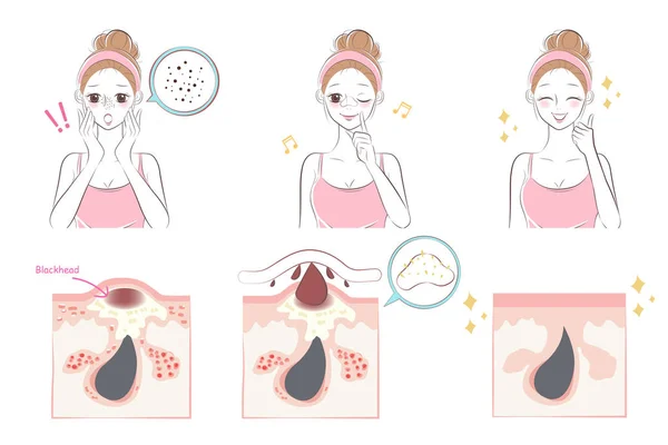 Dessin Animé Beauté Femme Avec Problème Acné Sur Nez Avant — Image vectorielle