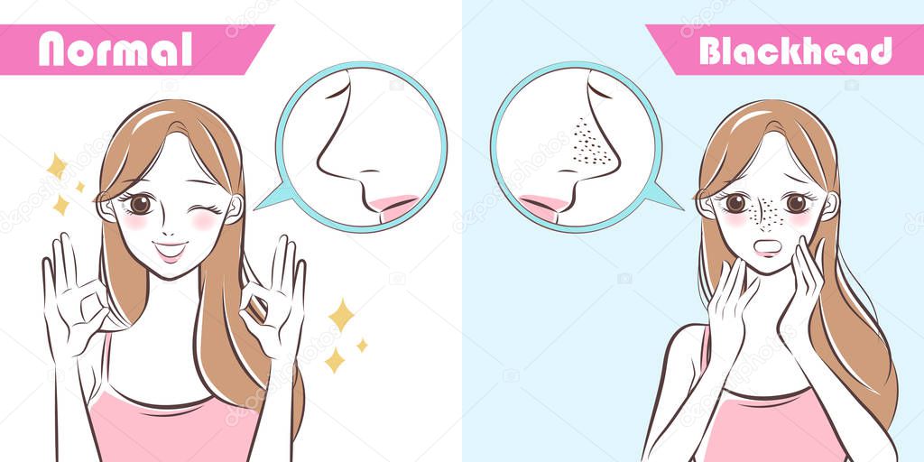 cartoon beauty woman with blackhead problem on nose before and after