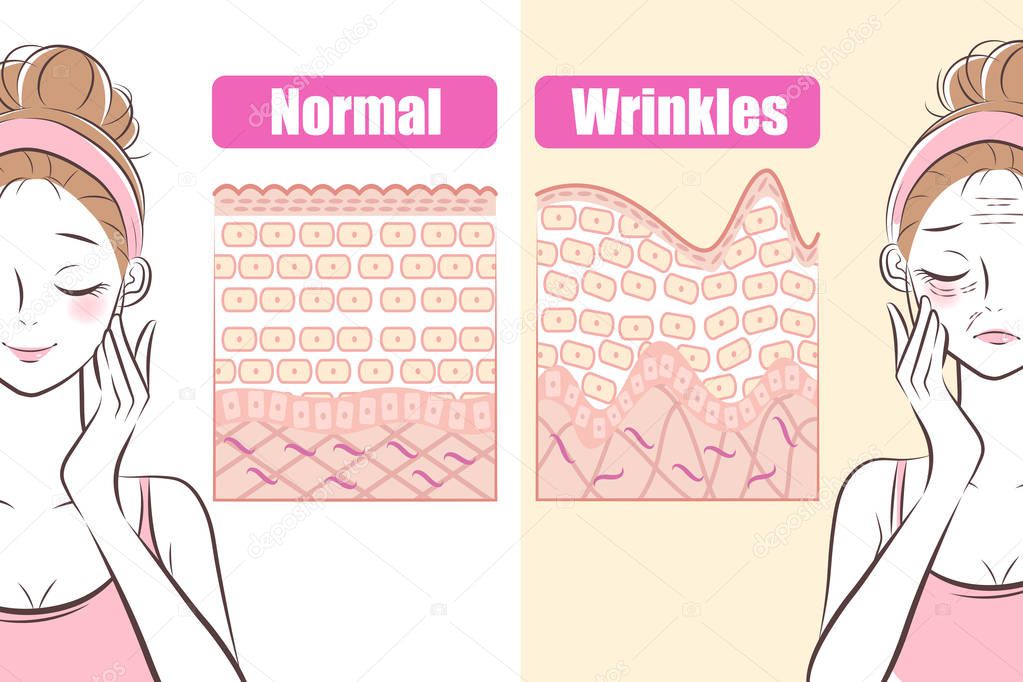 woman with wrinkles problem concept before and after