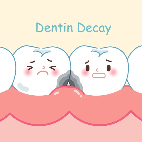 Tooth Met Dentine Verval Blauwe Achtergrond — Stockvector