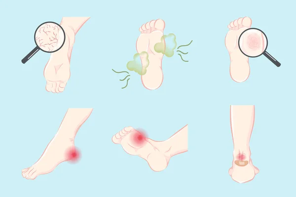 Toutes Sortes Problème Soins Peau Des Pieds Ensemble — Image vectorielle