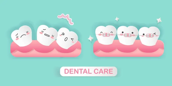 Cute Cartoon Tooth Brace Correction Concept — Stock Vector