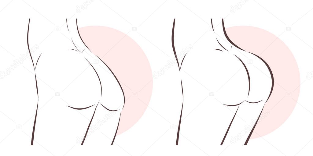 beauty woman with butt implant