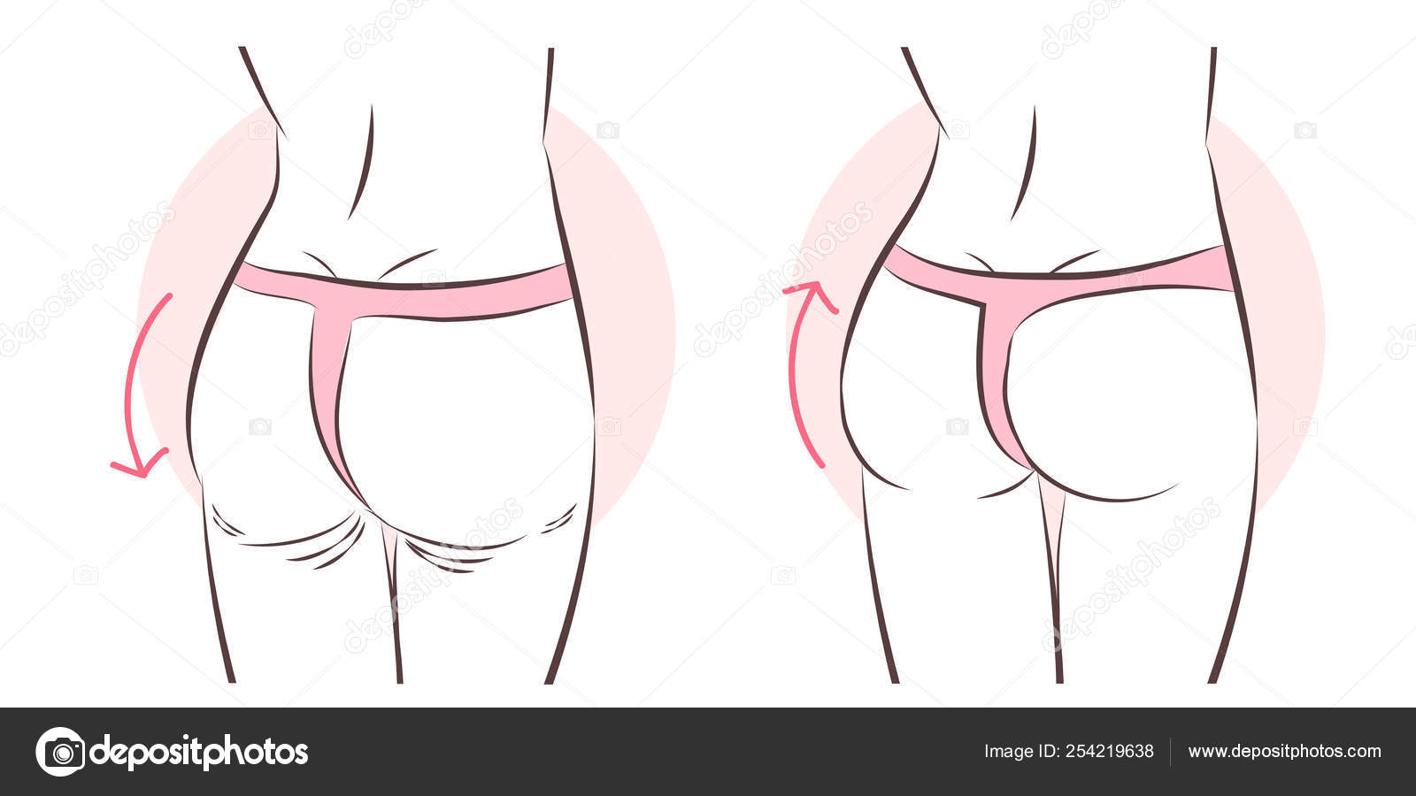 Butt implant before and after Stock Vector by ©estherqueen999
