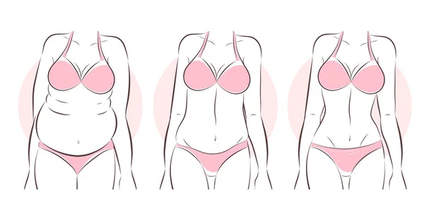Woman before and after liposuction — Stock Vector