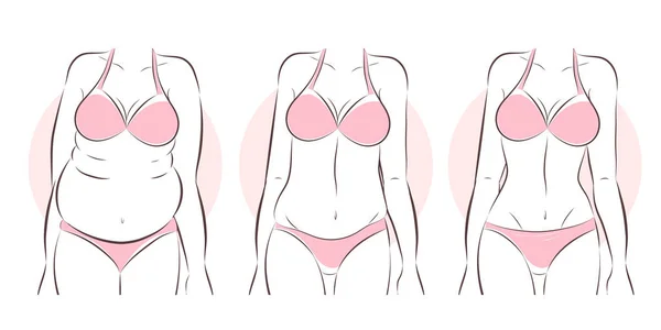 Mulher antes e depois da lipoaspiração —  Vetores de Stock