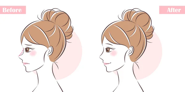 化粧鼻手術についての顔 — ストックベクタ