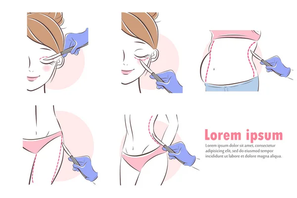 Mulher sobre cirurgia plástica — Vetor de Stock