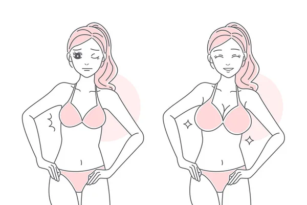 Woman has breast enlargement — 스톡 벡터