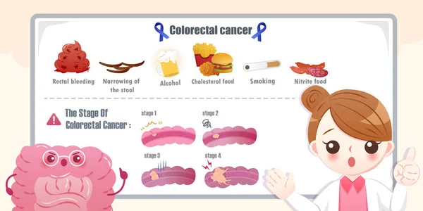 Cáncer colorrectal — Vector de stock