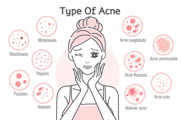 Cuidados com a pele tipo de acne —  Vetores de Stock