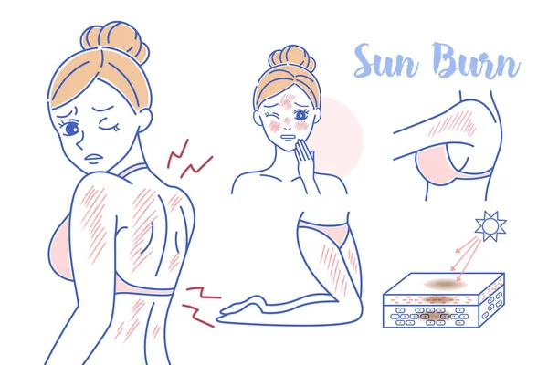 Beauté dessin animé femme avec coup de soleil — Image vectorielle