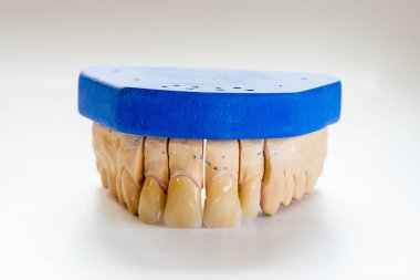 Diş hekimi laboratuvar ofis - diş alçı model yakın çekim. Alçı protez porselen dişleri beyaz arka plan üzerinde - kopya alanı izole